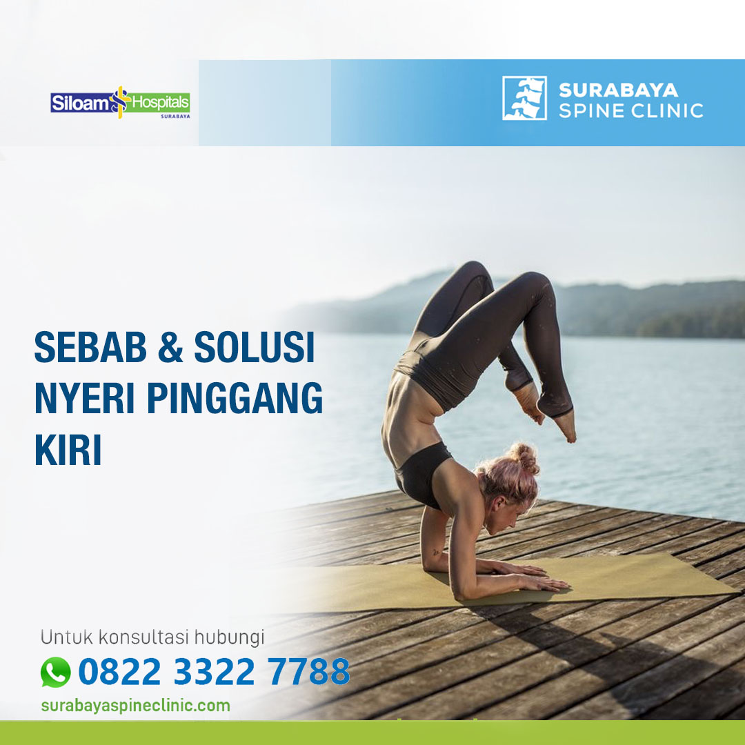 Memahami Penyebab dan Solusi Nyeri / Sakit Pinggang Sebelah Kiri